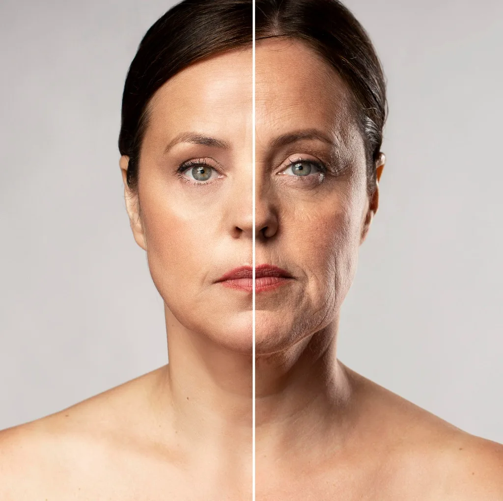 Ressecamento e Pele Frágil (Skinbooster)